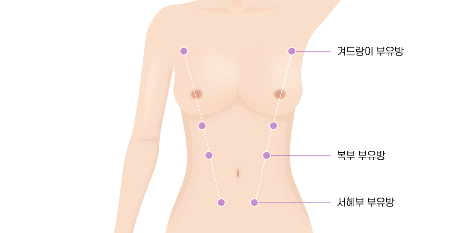 부유방 원인