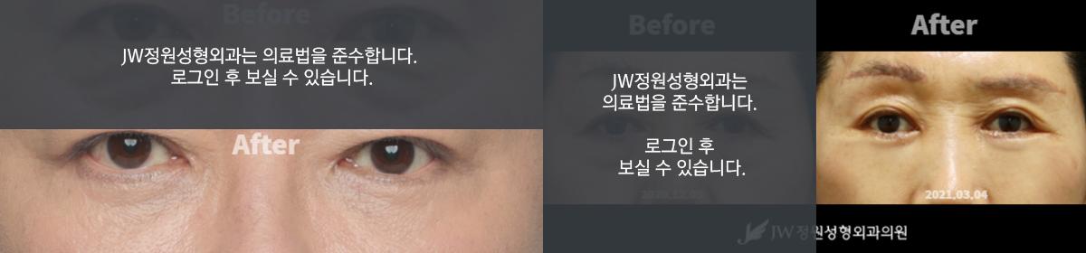 중안면지방거상 - 로그인 후 보실 수 있습니다.