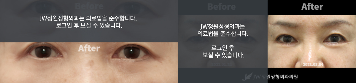 후기 이미지 1 - 로그인 후 보실 수 있습니다.