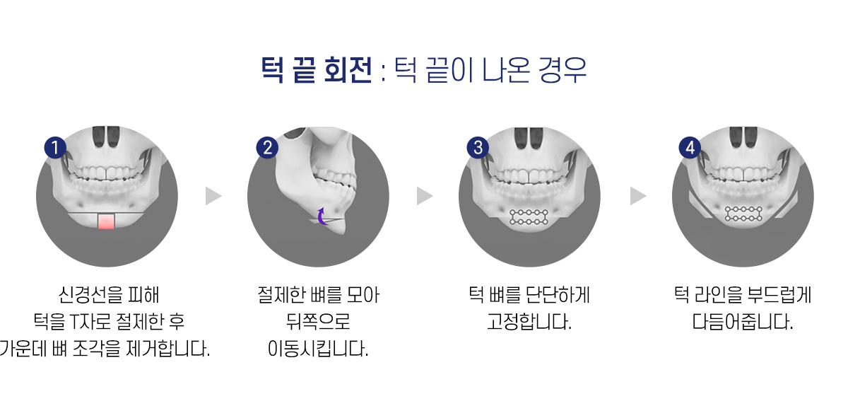 턱 끝 회전