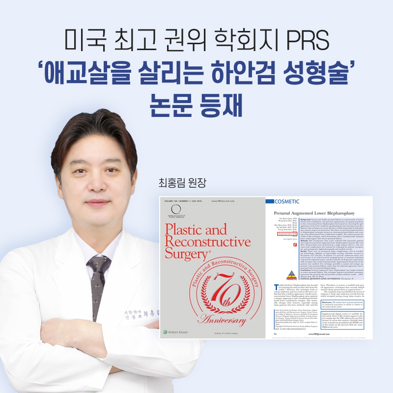 하안검 성형술 논문 등재