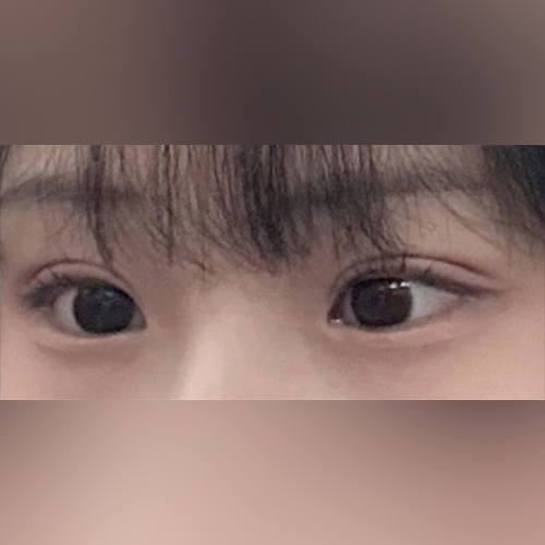매몰