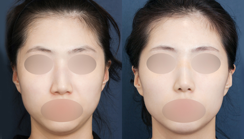 포토후기 이미지