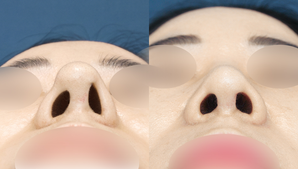 포토후기 이미지