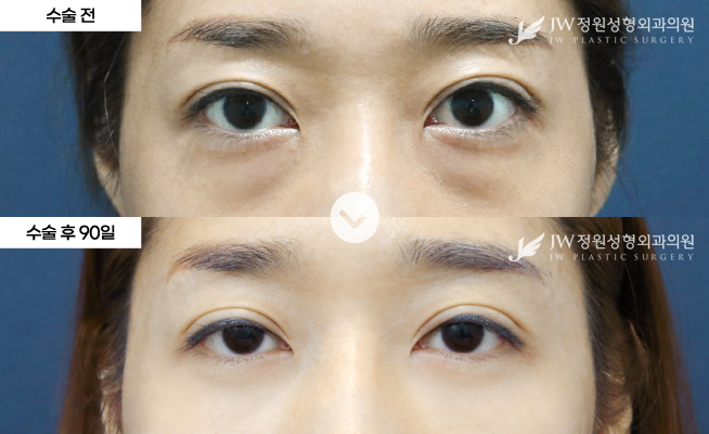 포토후기 이미지