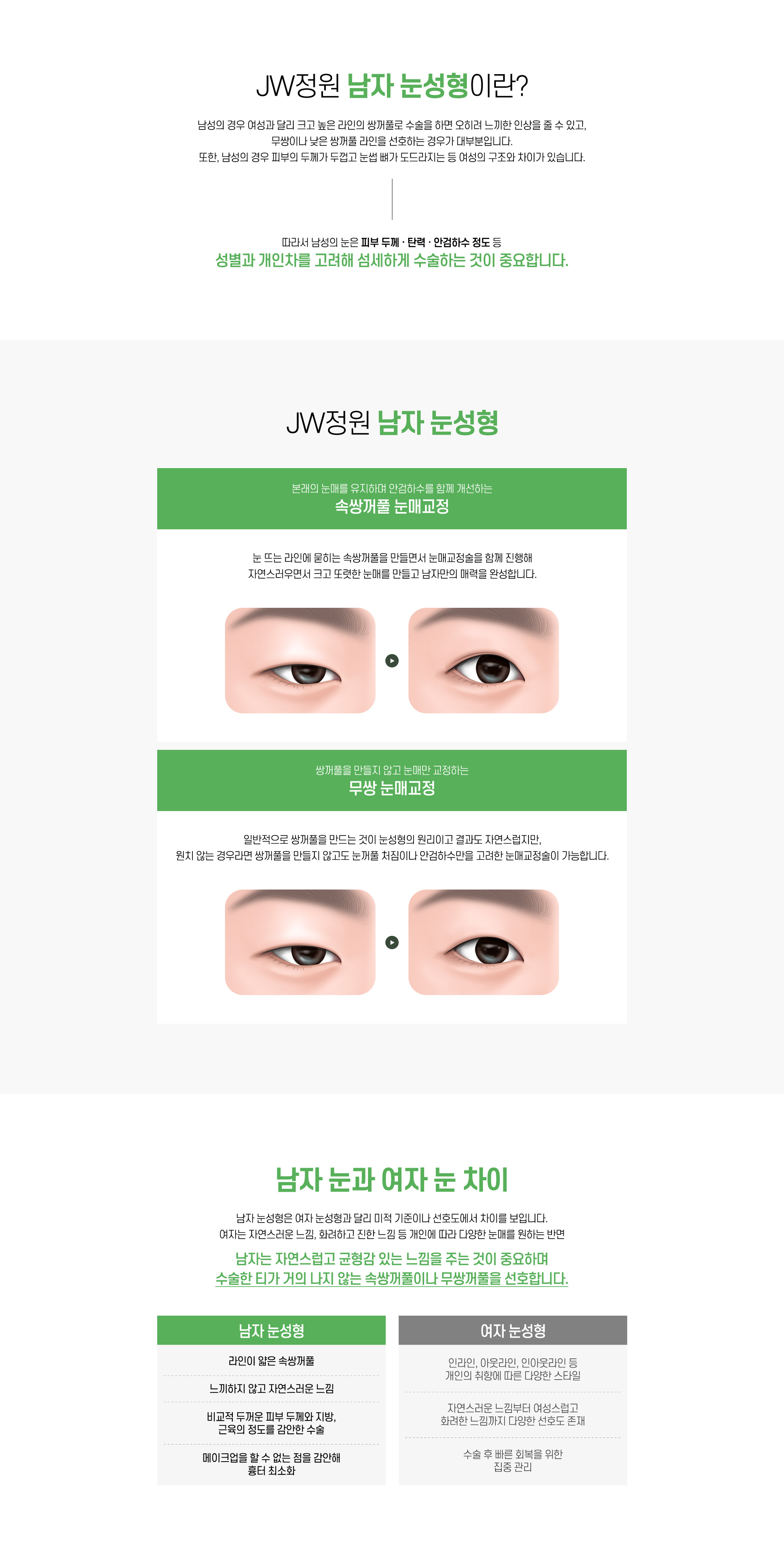 정원성형외과 남자 눈성형